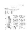 脊椎疾患について