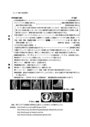 MRI と CT 比較チャート